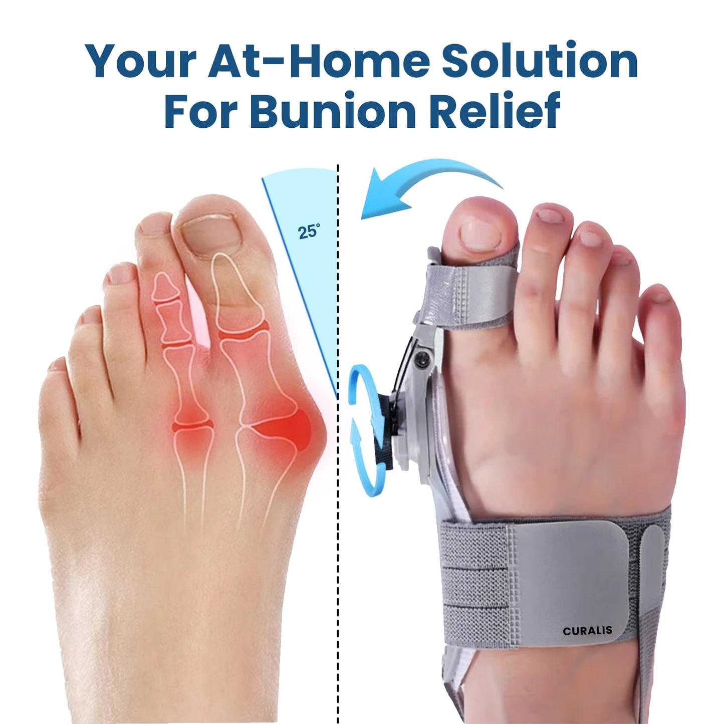 🎁Last Day Sale 49% OFF🔥Alwrita™ Bunion Relief