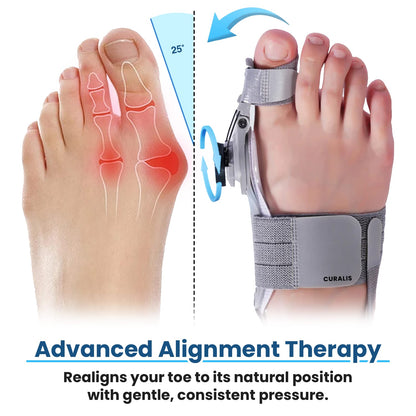 🎁Last Day Sale 49% OFF🔥Alwrita™ Bunion Relief