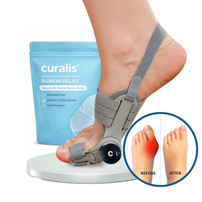 🎁Last Day Sale 49% OFF🔥Alwrita™ Bunion Relief