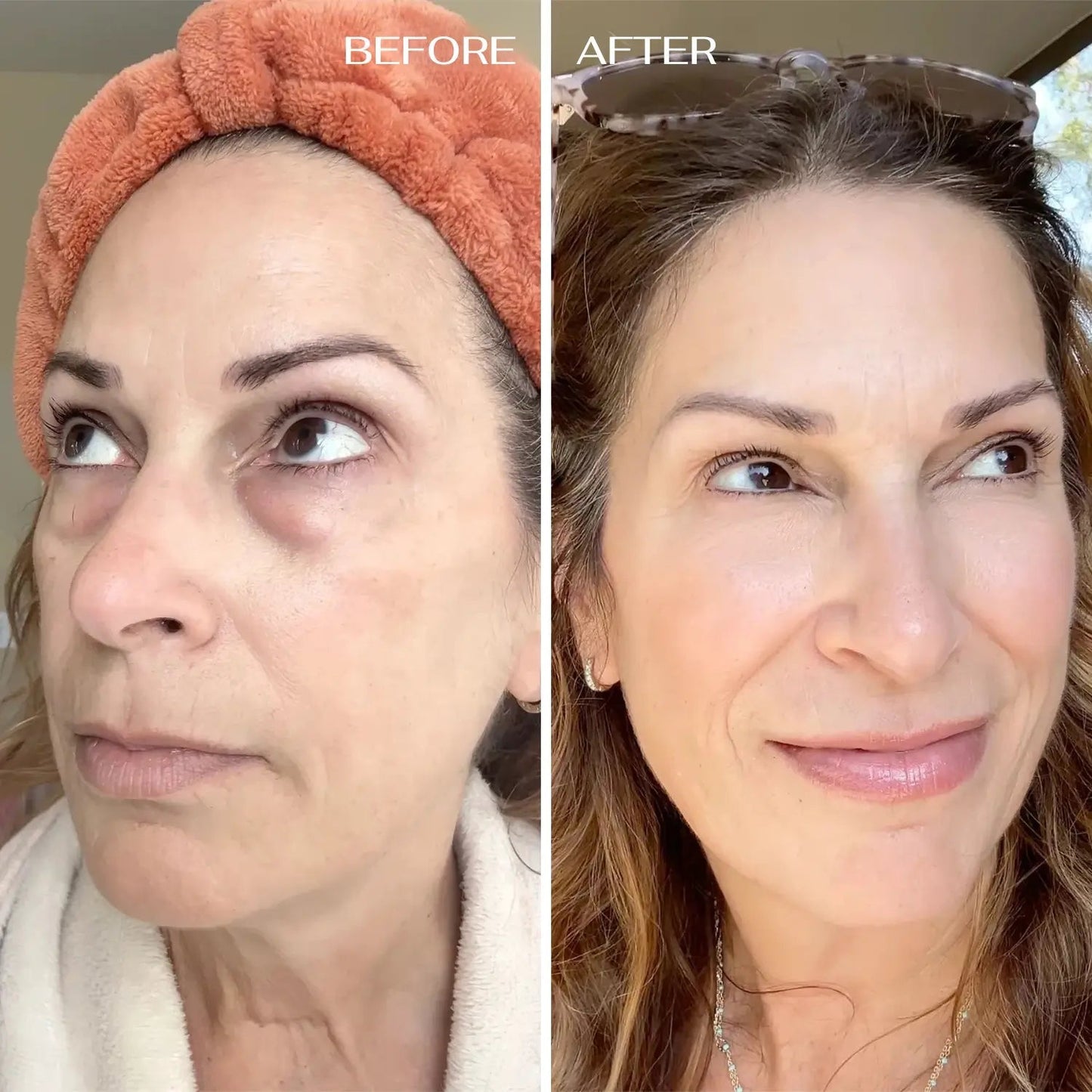 🔥Final 3 Hours : Only Limited Stock Left💖ALL-IN-ONE BALM FOR UNDER-EYE RENEWAL